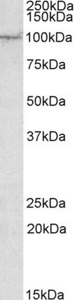 AAK1 Antibody in Western Blot (WB)