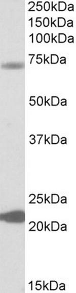 KCNN2 Antibody in Western Blot (WB)