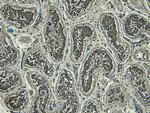 Blimp-1 Antibody in Immunohistochemistry (Paraffin) (IHC (P))