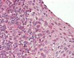 Blimp-1 Antibody in Immunohistochemistry (Paraffin) (IHC (P))