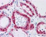 GPI Antibody in Immunohistochemistry (Paraffin) (IHC (P))