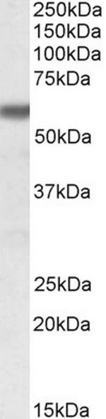 GPI Antibody in Western Blot (WB)