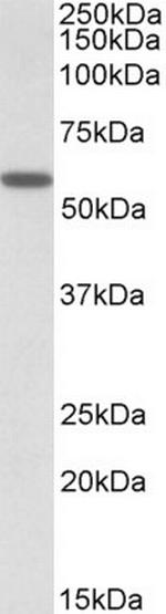 DIXDC1 Antibody in Western Blot (WB)