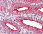 SNX1 Antibody in Immunohistochemistry (Paraffin) (IHC (P))