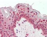 TIA1/TIAL1 Antibody in Immunohistochemistry (Paraffin) (IHC (P))