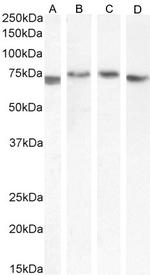 TGFBI Antibody in Western Blot (WB)