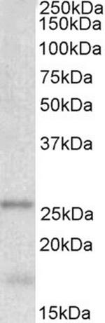 TPPP Antibody in Western Blot (WB)