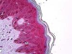 TRIM29 Antibody in Immunohistochemistry (Paraffin) (IHC (P))