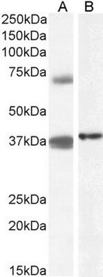 TRIM29 Antibody in Western Blot (WB)