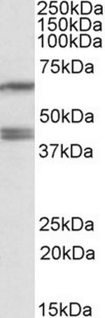 PON2 Antibody in Western Blot (WB)