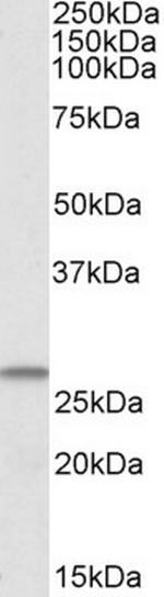 CHCHD3 Antibody in Western Blot (WB)