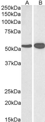 GluD1/GluD2 Antibody in Western Blot (WB)