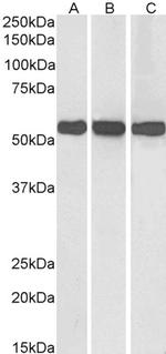 GluD1/GluD2 Antibody in Western Blot (WB)