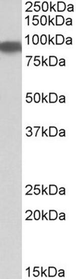 Aconitase 2 Antibody in Western Blot (WB)