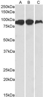 Aconitase 2 Antibody in Western Blot (WB)