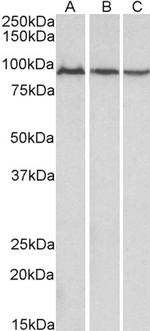 Aconitase 2 Antibody in Western Blot (WB)