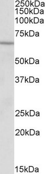 ACADVL Antibody in Western Blot (WB)