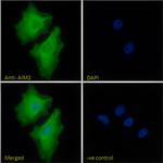 AIM2 Antibody in Immunocytochemistry (ICC/IF)