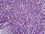 AIM2 Antibody in Immunohistochemistry (Paraffin) (IHC (P))