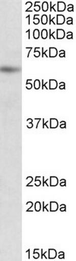 PIAS2 Antibody in Western Blot (WB)