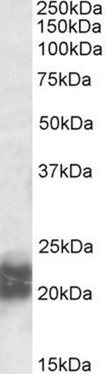 NPC2 Antibody in Western Blot (WB)