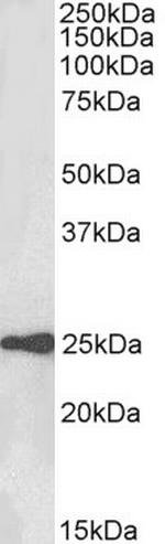 WFDC2 Antibody in Western Blot (WB)