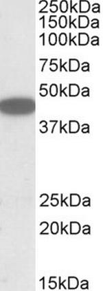 CXCR6 Antibody in Western Blot (WB)