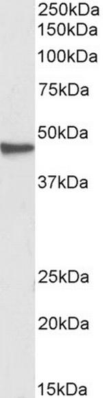 GNAS Antibody in Western Blot (WB)