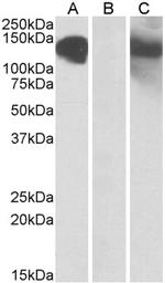 CDH11 Antibody in Western Blot (WB)