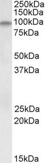 alpha Dystroglycan Antibody in Western Blot (WB)