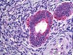 PLA2G4A Antibody in Immunohistochemistry (Paraffin) (IHC (P))