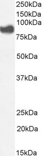 PLA2G4A Antibody in Western Blot (WB)