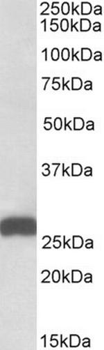 ETFB Antibody in Western Blot (WB)