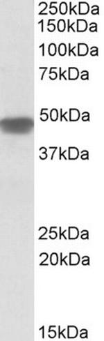 NDUFS2 Antibody in Western Blot (WB)