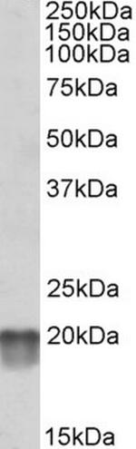 NDUFS7 Antibody in Western Blot (WB)