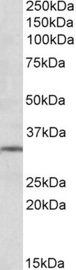 mGluR2 Antibody in Western Blot (WB)