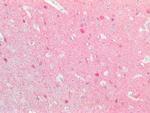 PGP9.5 Antibody in Immunohistochemistry (Paraffin) (IHC (P))