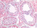 PGP9.5 Antibody in Immunohistochemistry (Paraffin) (IHC (P))