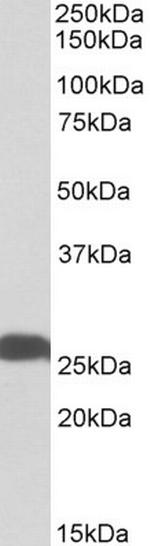 PGP9.5 Antibody in Western Blot (WB)