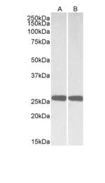 PGP9.5 Antibody in Western Blot (WB)