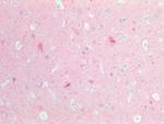 PGP9.5 Antibody in Immunohistochemistry (Paraffin) (IHC (P))