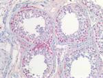 PGP9.5 Antibody in Immunohistochemistry (Paraffin) (IHC (P))