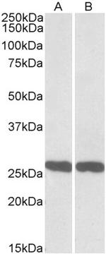 PGP9.5 Antibody in Western Blot (WB)