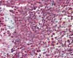 D4-GDI Antibody in Immunohistochemistry (Paraffin) (IHC (P))