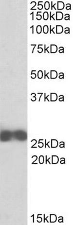 D4-GDI Antibody in Western Blot (WB)