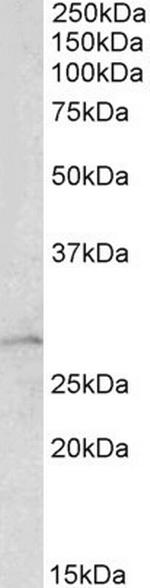 RhoGDI Antibody in Western Blot (WB)