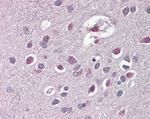 ARHGDIG Antibody in Immunohistochemistry (Paraffin) (IHC (P))