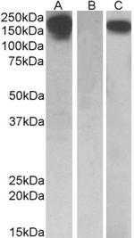 CSF1R Antibody in Western Blot (WB)