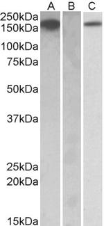 CSF1R Antibody in Western Blot (WB)