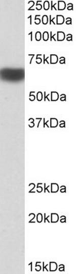 AMPK alpha-2 Antibody in Western Blot (WB)